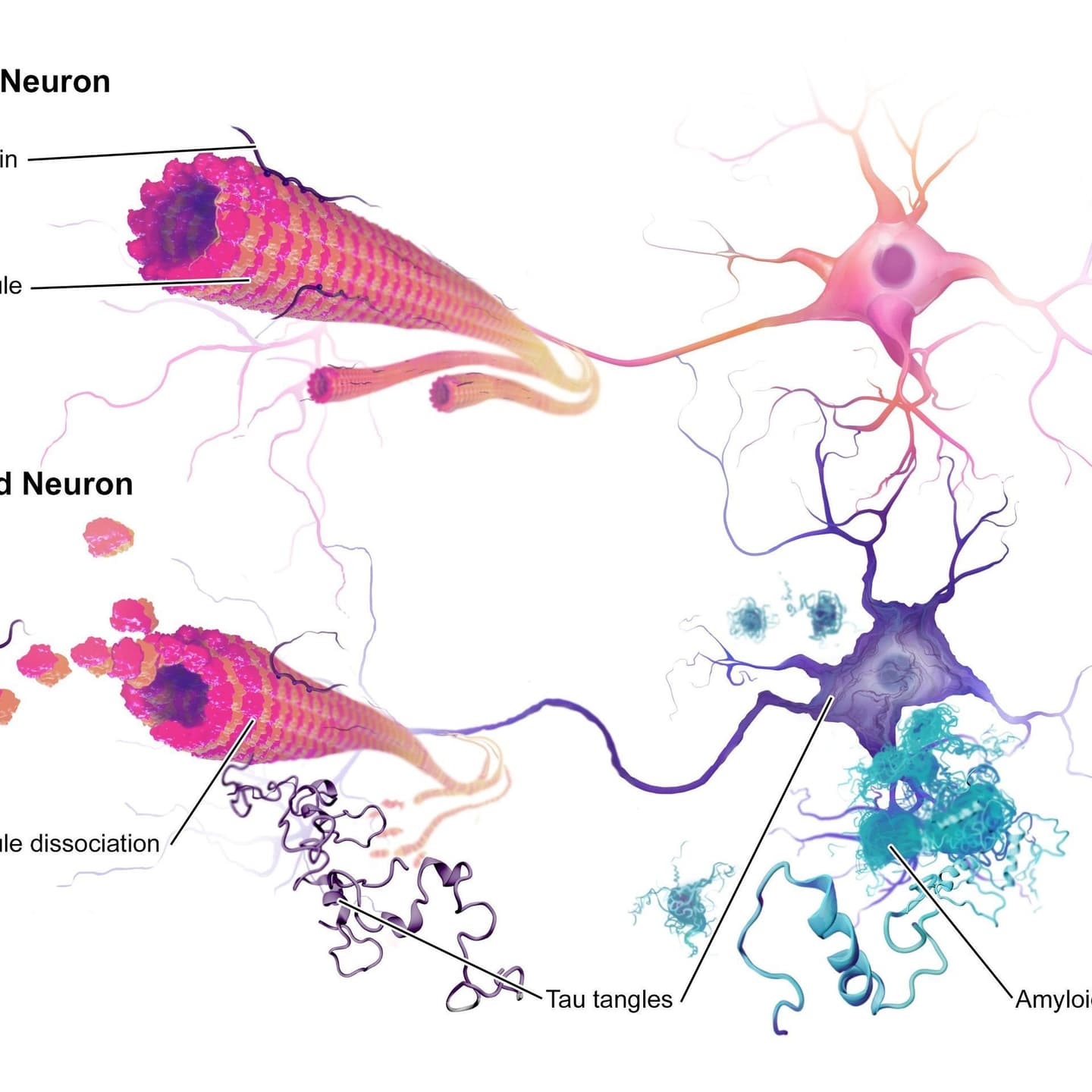 Study: Cannabinoids May Ease Dementia Symptoms in Alzheimer’s Patients