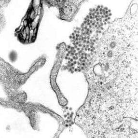 Dengue Vaccine Shows Effectiveness Under Real-World Conditions During Brazil's 2024 Outbreak