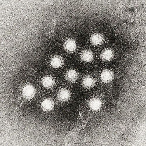 Warning in Dolj: Dsp Confirms 7 Hepatitis a Focus a. the Doctors Have Recorded Approximately 150 Cases